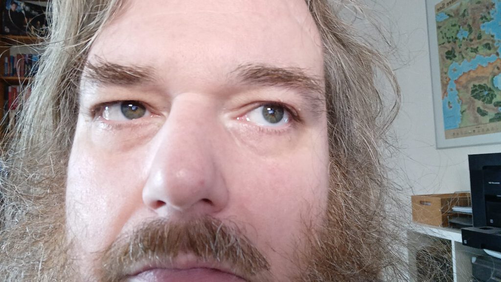 Gestern noch gehüpft – heute liege ich bereits auf der Fresse